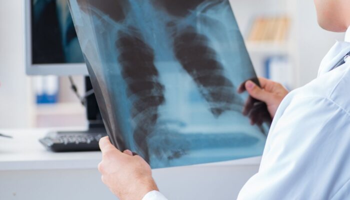 Taakherschikking onder de loep: afstemming tussen PA en radioloog niet voldoende Taakherschikking onder de loep: afstemming tussen PA en radioloog niet voldoende